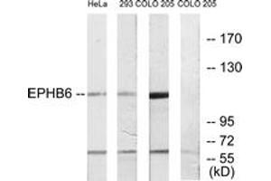 Western blot analysis of extracts from COLO/293/HeLa cells, using EPHB6 Antibody. (EPH Receptor B6 antibody  (AA 861-910))