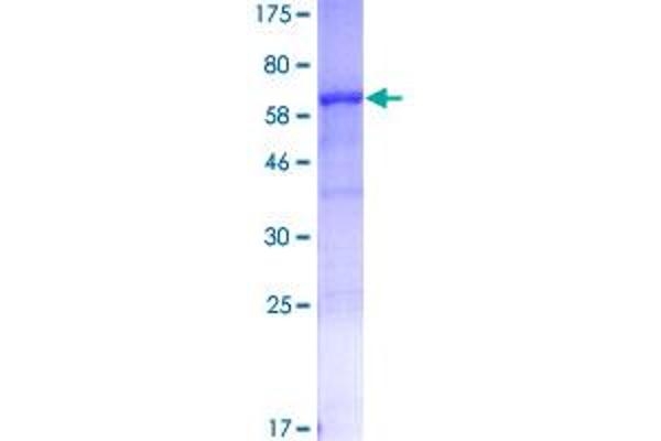 SERPINB3 Protein (AA 1-390) (GST tag)