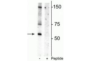 Western blot of rat striatal lysate showing specific immunolabeling of the ~55 kDa glycosylated form of the DAT protein phosphorylated at Thr53 in the first lane (-). (SLC6A3 antibody  (pThr53))