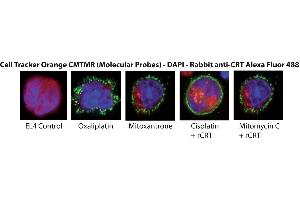Immunofluorescence   Cells were possibly incubated with rCRT , Adipogen) and stained with the same protocol than for FACS analysis. (Calreticulin Protein (CALR) (His tag))
