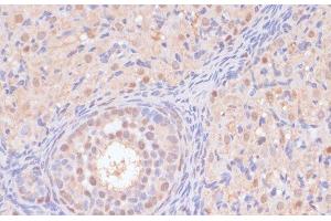 Immunohistochemistry of paraffin-embedded Rat ovary using BYSL Polyclonal Antibody at dilution of 1:100 (40x lens). (Bystin-Like antibody)