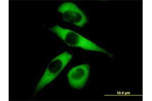 Immunofluorescence of purified MaxPab antibody to MARS on HeLa cell.