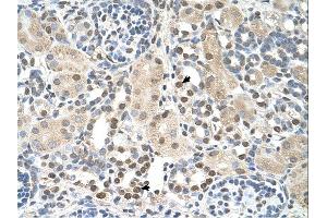 Immunohistochemistry (IHC) image for anti-phosphoserine Aminotransferase 1 (PSAT1) (N-Term) antibody (ABIN2782576) (PSAT1 antibody  (N-Term))