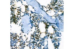 Immunohistochemistry of paraffin embedded mouse bone using AHSP (ABIN7073016) at dilution of 1:300 (400x lens) (aHSP antibody)
