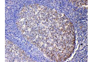 IHC analysis of IL13 using anti-IL13 antibody . (IL-13 antibody  (AA 36-146))