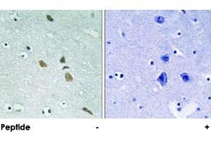 Immunohistochemical analysis of paraffin-embedded human brain tissue using ILK polyclonal antibody . (ILK antibody)