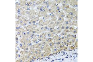 Immunohistochemistry of paraffin-embedded human liver injury using OSGEPL1 antibody (ABIN5974954) at dilution of 1/100 (40x lens).