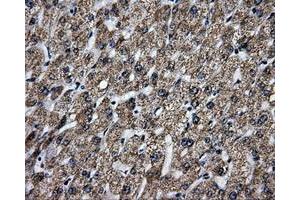 Immunohistochemical staining of paraffin-embedded liver tissue using anti-BRAFmouse monoclonal antibody. (BRAF antibody)