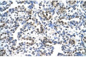 Human Lung (MRPS15 antibody  (N-Term))