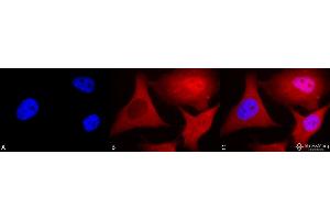 Immunocytochemistry/Immunofluorescence analysis using Mouse Anti-Ubiquitin Monoclonal Antibody, Clone 6C11-B3 . (Ubiquitin antibody  (PE))