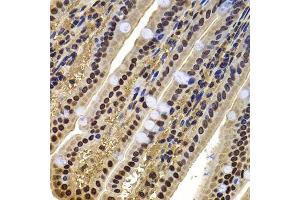 Immunohistochemistry (Paraffin-embedded Sections) (IHC (p)) image for anti-Actin-Like 6B (ACTL6B) (AA 1-280) antibody (ABIN6136481)