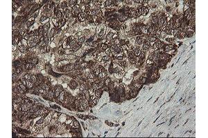 Image no. 7 for anti-Family with Sequence Similarity 164, Member A (FAM164A) antibody (ABIN1498198) (FAM164A antibody)