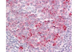 Anti-TSHZ1 antibody IHC staining of human tonsil. (TSHZ1 antibody  (N-Term))