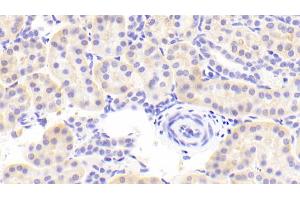 Detection of FPN in Human Kidney Tissue using Polyclonal Antibody to Ferroportin (FPN) (SLC40A1 antibody  (AA 127-321))