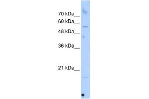 WB Suggested Anti-SEPN1 Antibody Titration:  0. (SEPN1 antibody  (C-Term))