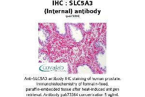Image no. 1 for anti-Solute Carrier Family 5 Member 3 (SLC5A3) (Internal Region) antibody (ABIN1739401)