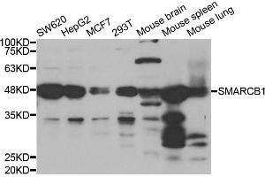 Western blot analysis of extracts of various cell lines, using SMARCB1 antibody (ABIN5973389) at 1/1000 dilution. (SMARCB1 antibody)