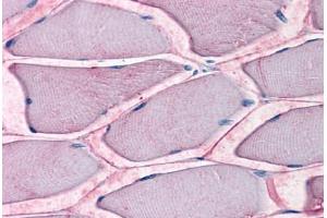 Human Skeletal Muscle: Formalin-Fixed, Paraffin-Embedded (FFPE) (SLC1A5 antibody  (Internal Region))