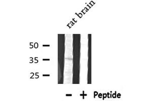 Western blot analysis of extracts from Rat brain lysate, using DGAT2L6 antibody.