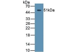 Detection of Recombinant ASPH, Human using Monoclonal Antibody to Aspartate Beta Hydroxylase (ASPH) (Aspartate beta Hydroxylase antibody  (AA 345-758))