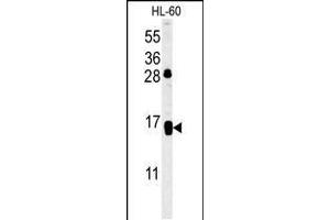 Western blot analysis in HL-60 cell line lysates (35ug/lane). (CD69 antibody  (AA 119-148))