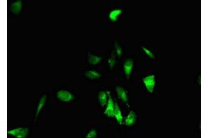 Immunofluorescent analysis of Hela cells using ABIN7151870 at dilution of 1:100 and Alexa Fluor 488-congugated AffiniPure Goat Anti-Rabbit IgG(H+L) (EPH Receptor B6 antibody  (AA 410-553))