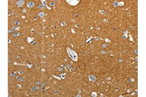 The image on the left is immunohistochemistry of paraffin-embedded Human brain tissue using ABIN7192659(SSTR4 Antibody) at dilution 1/25, on the right is treated with synthetic peptide. (SSTR4 antibody)