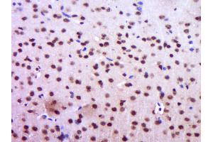 Immunohistochemistry (Paraffin-embedded Sections) (IHC (p)) image for anti-Glyceraldehyde-3-Phosphate Dehydrogenase (GAPDH) (AA 1-335) antibody (ABIN678458)