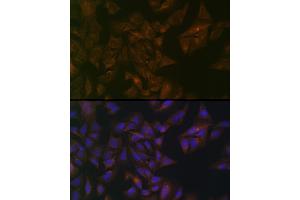 Immunofluorescence analysis of U-2 OS cells using Folate Binding Protein(FBP) / FOLR1 Rabbit pAb (ABIN7267224) at dilution of 1:100 (40x lens). (FOLR1 antibody  (AA 25-93))