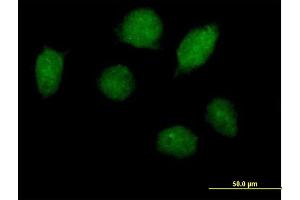 Immunofluorescence of purified MaxPab antibody to HOXA1 on HeLa cell. (HOXA1 antibody  (AA 1-335))