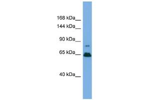 Western Blotting (WB) image for anti-Zinc Finger Protein 676 (ZNF676) (Middle Region) antibody (ABIN2787553) (ZNF676 antibody  (Middle Region))