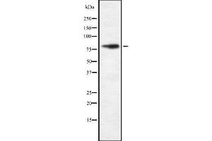 Western blot analysis FAKD2 using HeLa whole cell lysates (FASTKD2 antibody  (Internal Region))