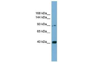 UNC5C antibody used at 1 ug/ml to detect target protein. (Unc5c antibody)