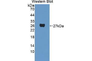 Western blot analysis of the recombinant protein. (PAG1 antibody  (AA 138-357))
