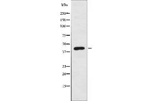 Western blot analysis of extracts from COLO cells, using DOK6 antibody. (DOK6 antibody  (Internal Region))