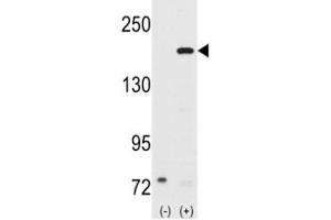 Western blot analysis of SRC-1 antibody and 293 cell lysate (2 ug/lane) either nontransfected (Lane 1) or transiently transfected with the NCOA1 gene (2). (NCOA1 antibody  (AA 186-214))