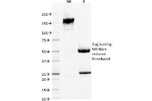SDS-PAGE Analysis Purified AIF1 / Iba1 Mouse Monoclonal Antibody (AIF1/1909).