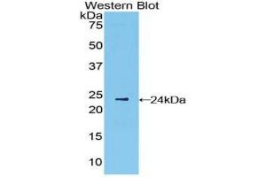 Western blot analysis of the recombinant protein. (IFNB1 antibody  (AA 22-187))