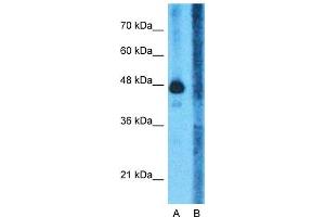 Western Blotting (WB) image for anti-Glutamate Dehydrogenase 1 (GLUD1) (N-Term) antibody (ABIN2782330)