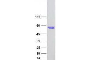 Western Blotting (WB) image for AT Rich Interactive Domain 3C (BRIGHT-Like) (ARID3C) protein (Myc-DYKDDDDK Tag) (ABIN2714899)