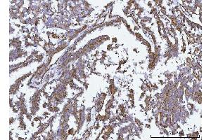 IHC analysis of GLUD1/2 using anti-GLUD1/2 antibody (ABIN7602000). (GLUD1 / GLUD2 (AA 54-553) antibody)