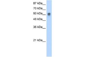 WB Suggested Anti-ZFP91 Antibody Titration:  0.
