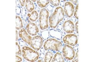 Immunohistochemistry of paraffin-embedded rat kidney using TST Rabbit pAb  at dilution of 1:200 (40x lens). (TST antibody  (AA 1-297))