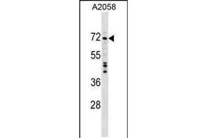 Western blot analysis in A2058 cell line lysates (35ug/lane). (DDX56 antibody  (C-Term))