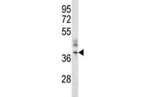 CRACM1 antibody western blot analysis in A375 lysate. (ORAI1 antibody  (AA 269-298))