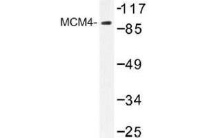 Image no. 1 for anti-Minichromosome Maintenance Deficient 4 (MCM4) antibody (ABIN317884) (MCM4 antibody)