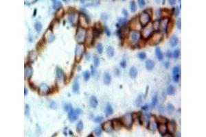 Used in DAB staining on fromalin fixed paraffin-embedded Kidney tissue (CD45 antibody  (AA 644-900))