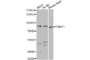 Western blot analysis of extracts of various cell lines, using TRMT1 antibody. (TRMT1 antibody)