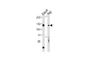 Rb Antibody  (ABIN1881730 and ABIN2840685) western blot analysis in Daudi,Raji cell line lysates (35 μg/lane).