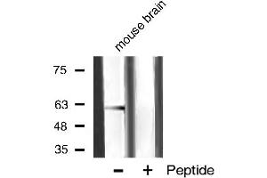 Western blot analysis of akt2 phosphorylation expression in mouse brain tissue lysates,The lane on the right is treated with the antigen-specific peptide.